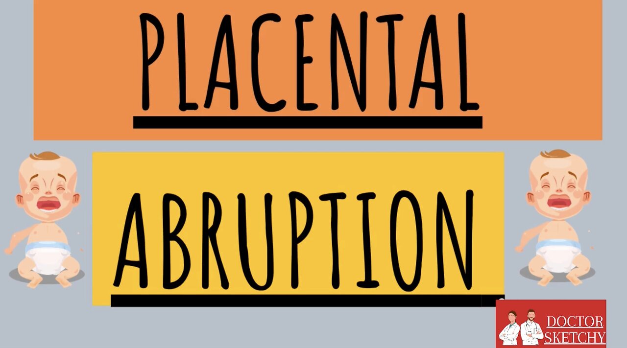 PLACENTAL ABRUPTION | Causes | Investigations | Management | Complications | DOCTOR SKETCHY