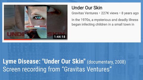 Under Our Skin (2008 Documentary) - 480p recording from YouTube