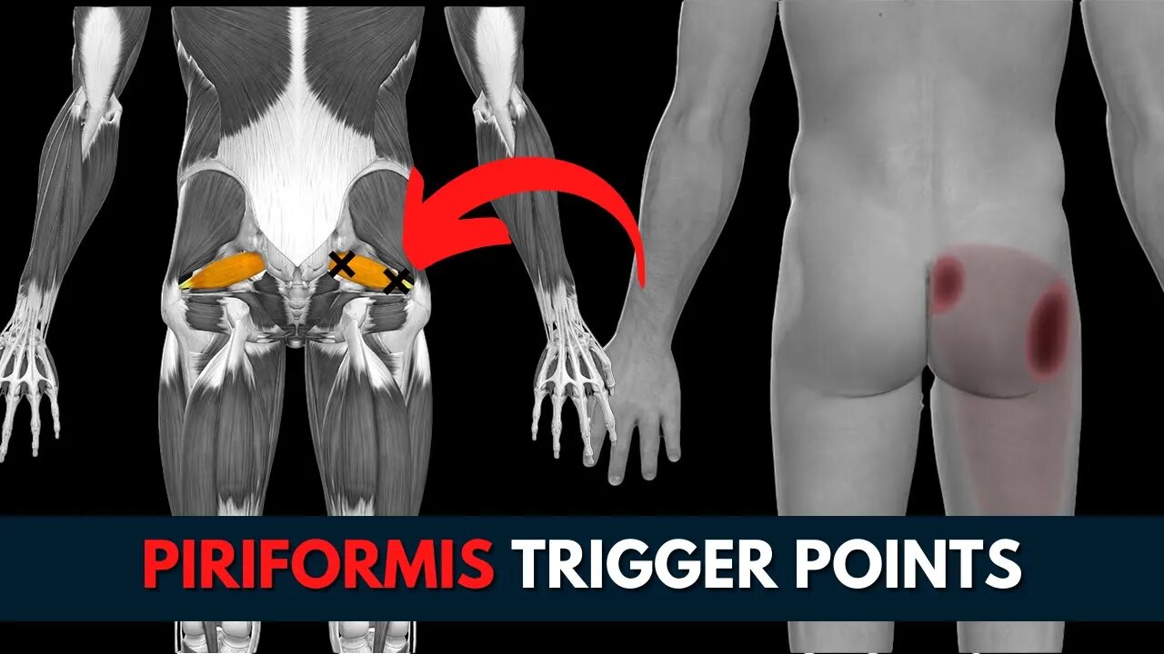 piriformis release technique | Eliminate Trigger Points #SHORT