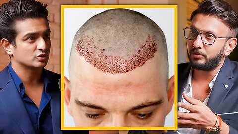 Real Reason Behind Your HAIR LOSS - Simple, Practical Explanation By Dermatologist