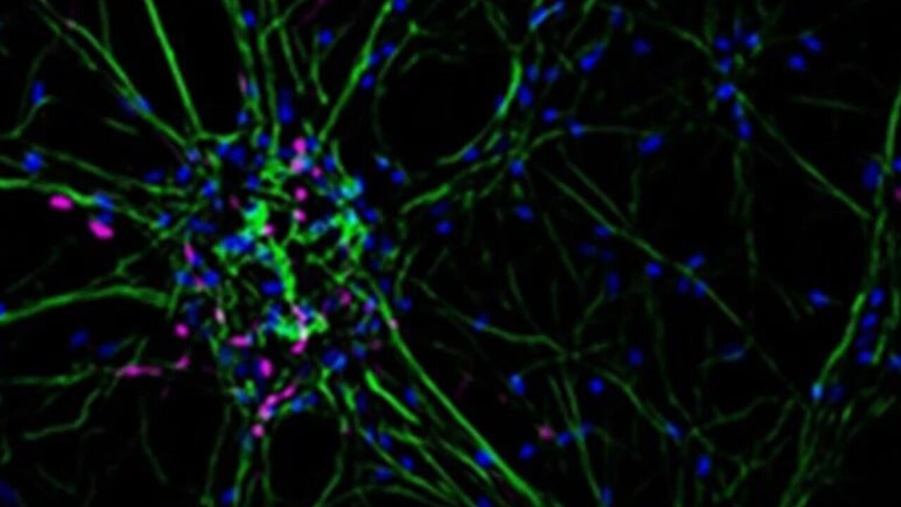 The Cellular Structure of the Mammalian Brain (1986) | Harold Hillman