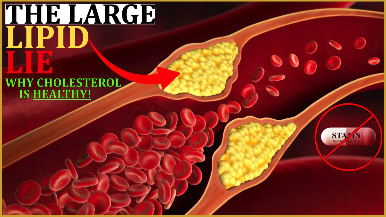 E110 - Cholesterol & Lipoproteins: Myths & Legends