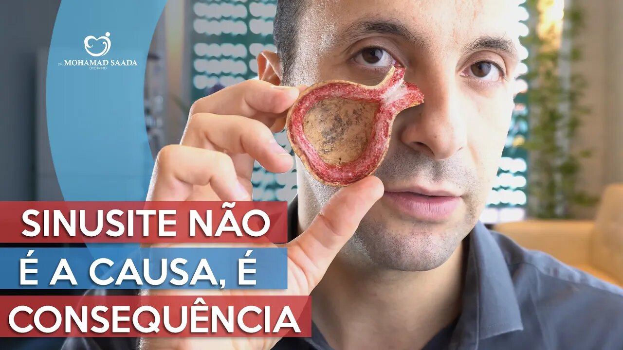 Sinusite Não é Causa é Consequência