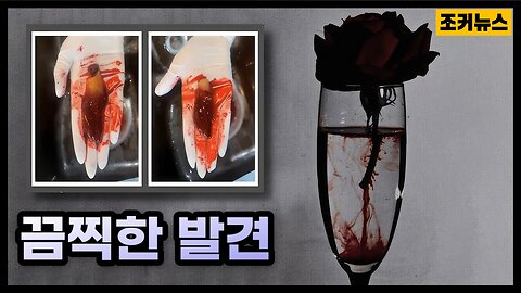 미접종자 혈액에서 끔찍한 발견 Horrifying findings in unvaccinated blood