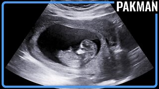 Would Confirming When Life "Begins" Really Solve Anything?