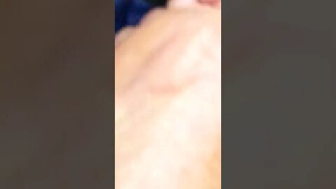 #homeless #targetedindividual tortured by ants Pt. 2