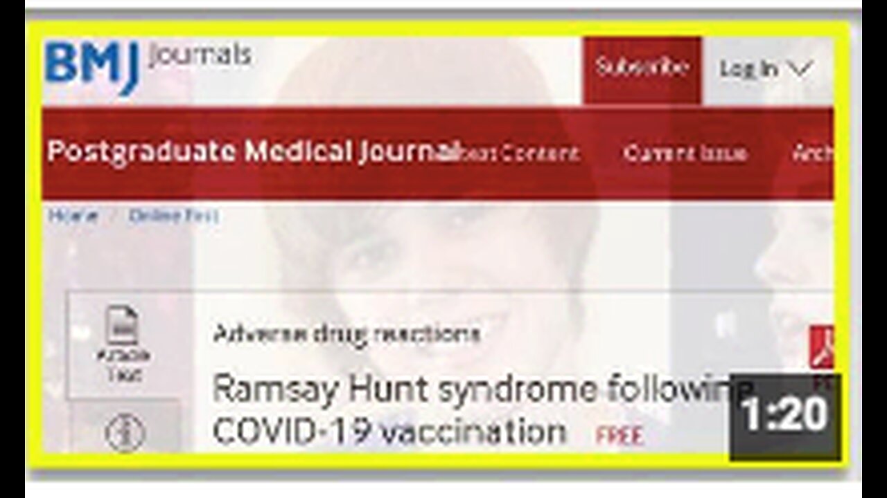 ROME FOLLOWING COVID-19 VACCINATION - BRITISH MEDICAL JOURNAL