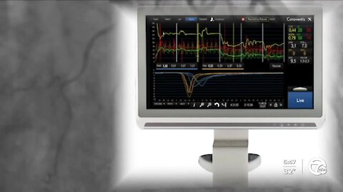 Life-saving procedure performed measuring blood flow in tiny vessels