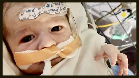 Baby Given Vaccinated Blood Infusion Dies Within Days From Blood clot