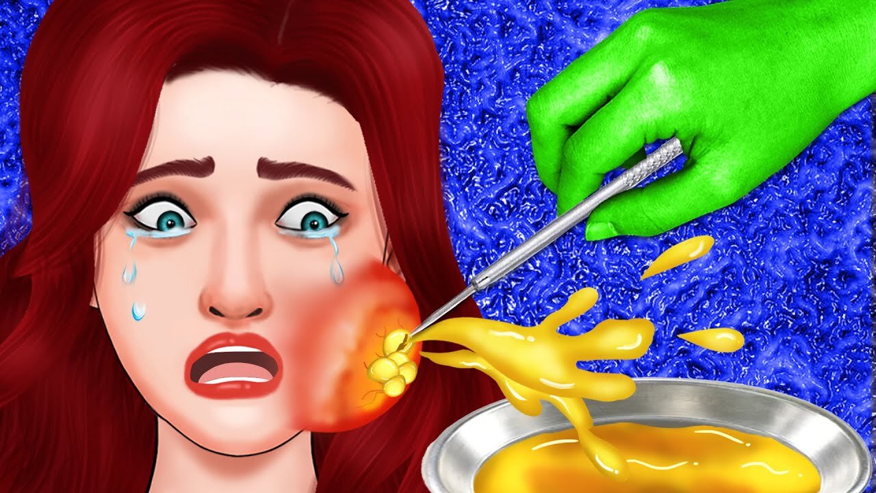 OMG! Ariel's Giant Abscess | ASMR Animation