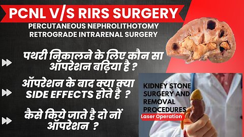 PCLS | RIRS | पथरी को निकालने के दो सफल ऑपरेशन | जानिये कौन सी SURGERY करवाएं | KIDNEY STONE SURGERY