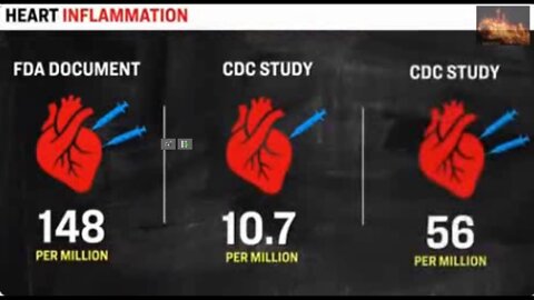 FDA Removes Data on Moderna Vaccine, Showed 2.6x Heart Inflammation