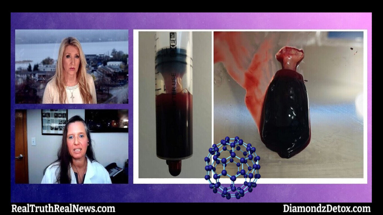 👾 Dr. Ana Mihalcea Discusses the NanoTechnology She's Finding in UNvaccinated Blood and How To Detox ⭐ Links 👇