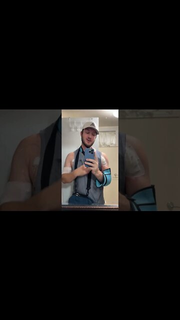 I tore my Pec Two Years Ago… and still dealing with it