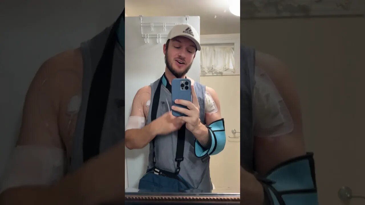 I tore my Pec Two Years Ago… and still dealing with it