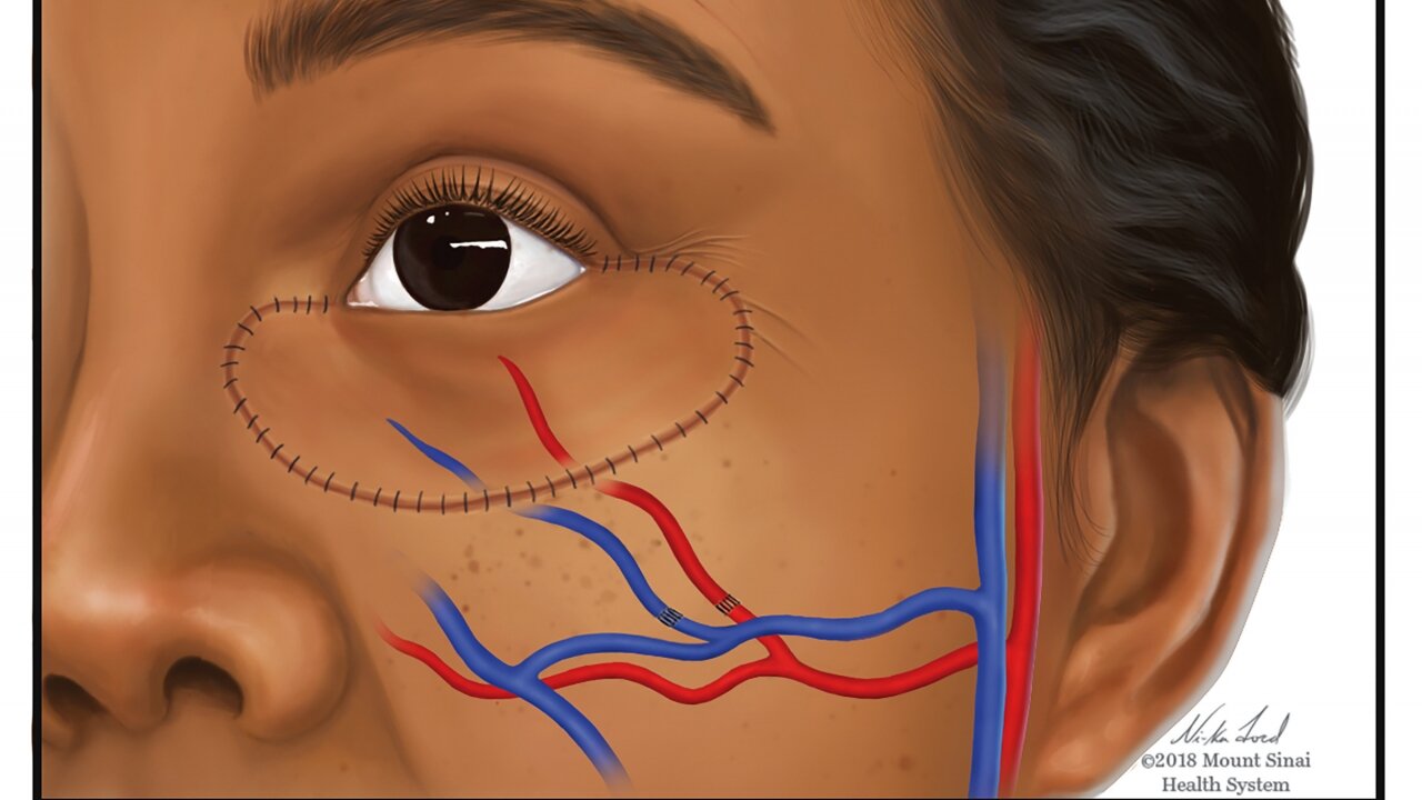 Medical Illustrators Address Representation In Publications