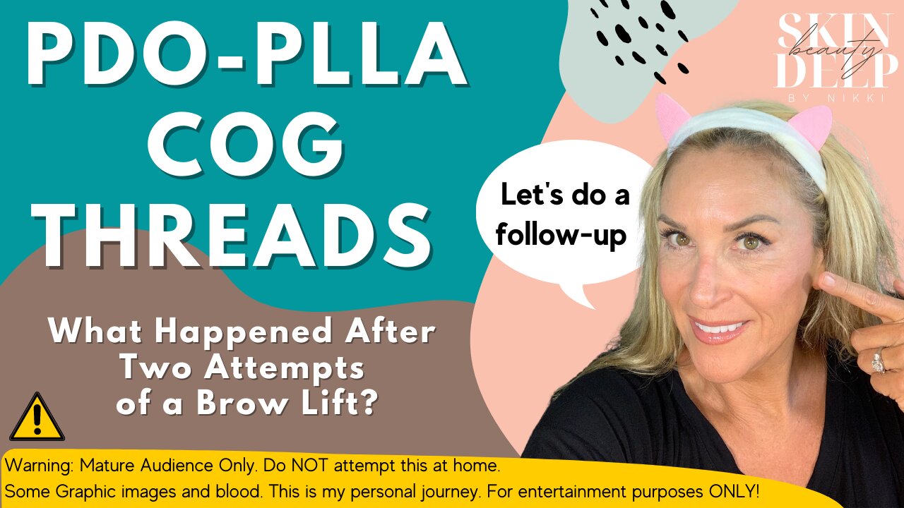 PDO COG THREAD RESULTS & FOLLOW-UP ~ Eye Brow Lift!