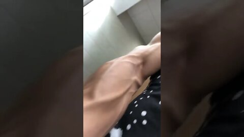 Vascularity pre injury