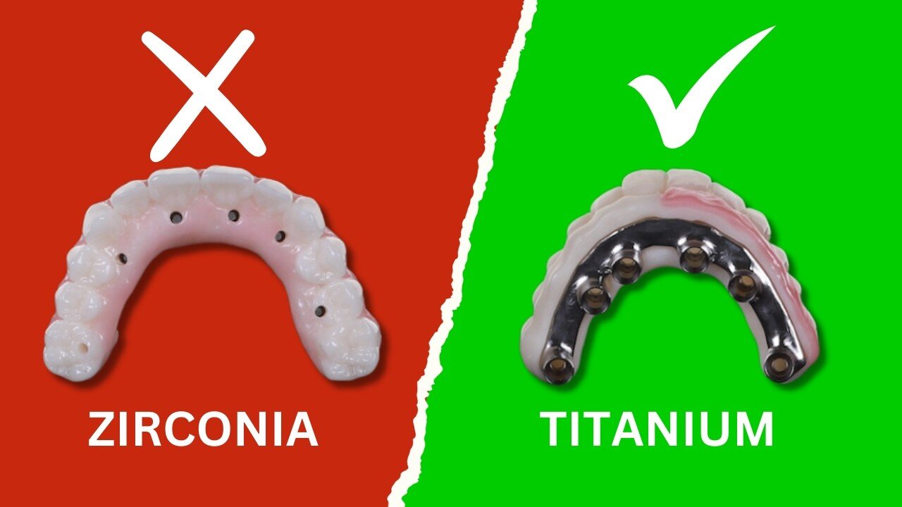 Why ZIRCONIA Isn't Enough | Get The Added Benefits Of Titanium