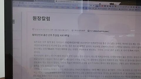 팔이 먼저 나오는 횡위난산과 출산 산후 튼살침치료 St침
