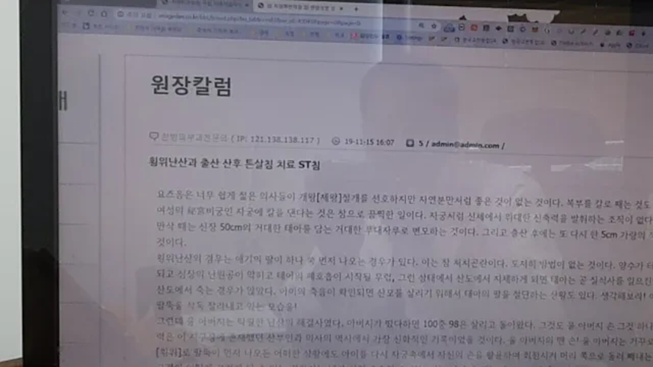 팔이 먼저 나오는 횡위난산과 출산 산후 튼살침치료 St침