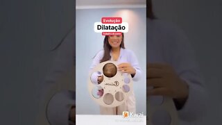 Evolução da dilatação do trabalho de parto