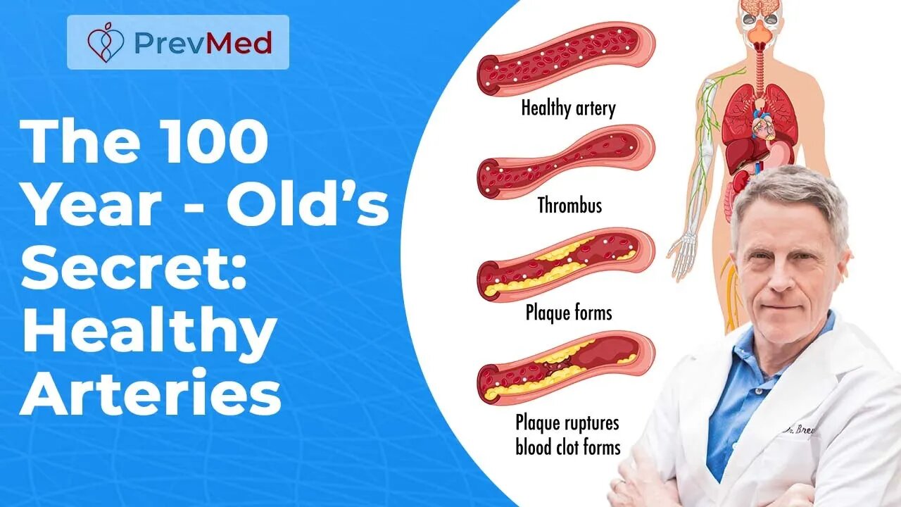 The 100 Year - Old’s Secret: Healthy Arteries