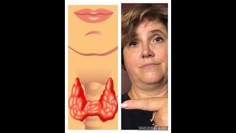 HYPOTHYROIDISM: THE STRUGGLES AND WHAT WORKS BEST WITH IT FOR WEIGHT LOSS