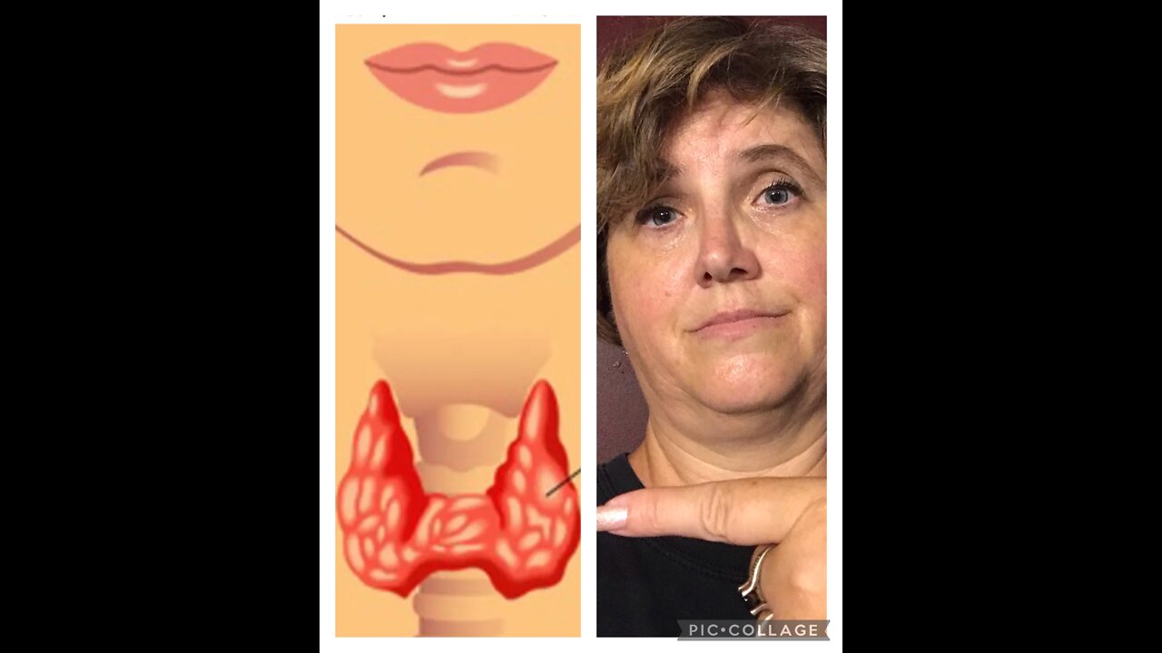 HYPOTHYROIDISM: THE STRUGGLES AND WHAT WORKS BEST WITH IT FOR WEIGHT LOSS