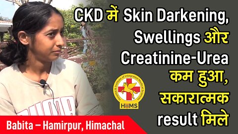 CKD में Skin Darkening, Swellings और Creatinine-Urea कम हुआ, सकारात्मक result मिले