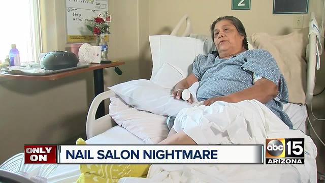 Valley woman gets major infection after nail salon visit