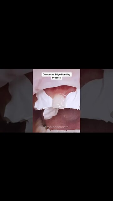 Dental And Teeth Hygiene