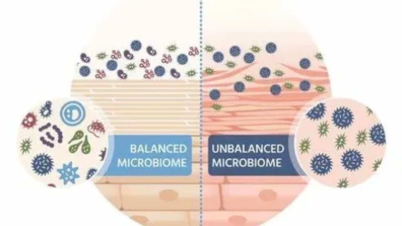 Ladies 50 and older do you have a healthy skin-gut microbiome?