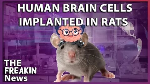 Scientists Transplant Human Brain Cells In Rats Sparking Optimism And Concerns