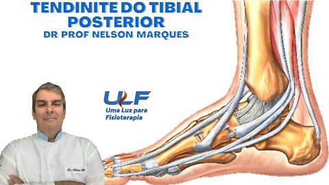 TENDINITE DO M. TIBIAL POSTERIOR - Dr. Prof. Nelson Marques