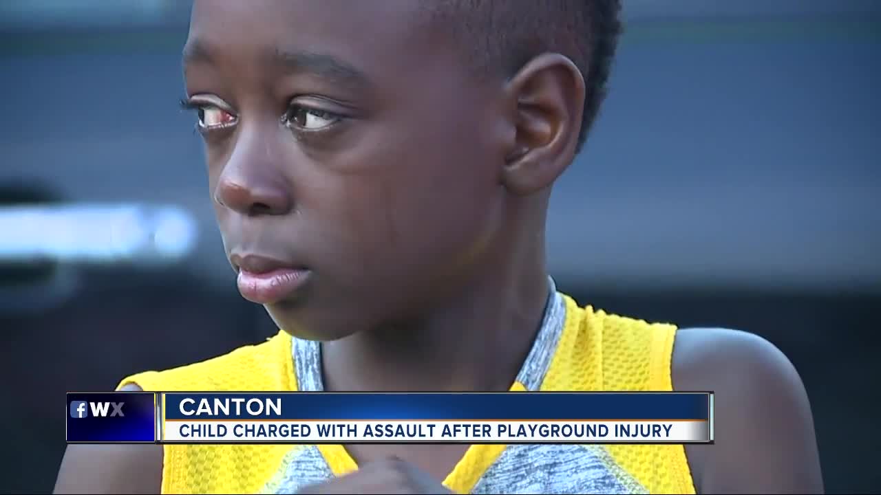 Canton 10-year-old charged with assault following schoolyard injury