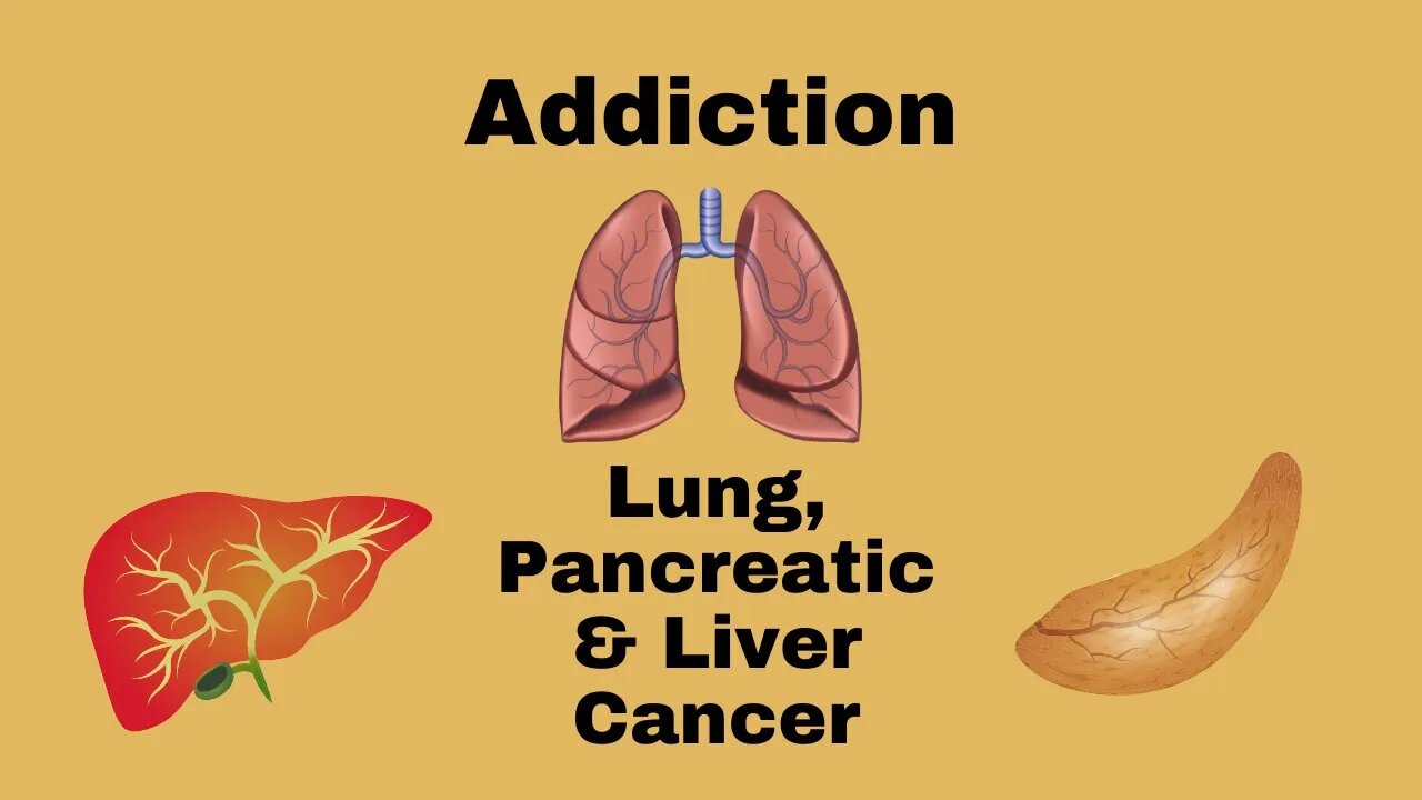 Addiction, Pancreatic and Lung Cancer