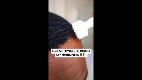 DAY 57 TRYING TO BRING MY HAIRLINE IN👨🏾‍🦲‼️