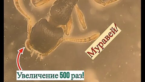 Глаз который видит! Муравей! Увеличение в 500 раз!