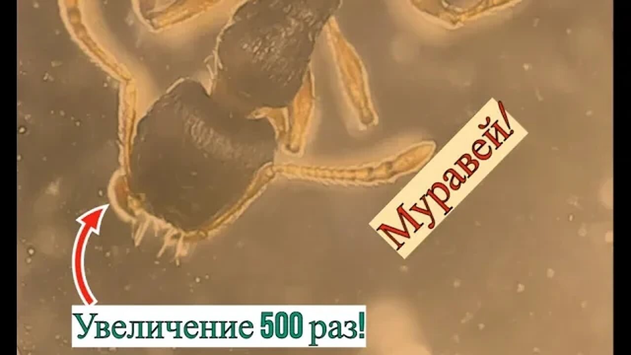 Глаз который видит! Муравей! Увеличение в 500 раз!