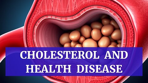 Empower Your Health: Essential Foods and Habits for Optimal Cholesterol Balance