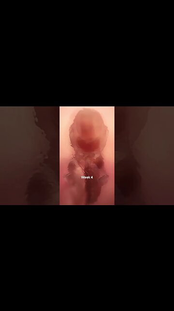 Abortion Kills A Human Life