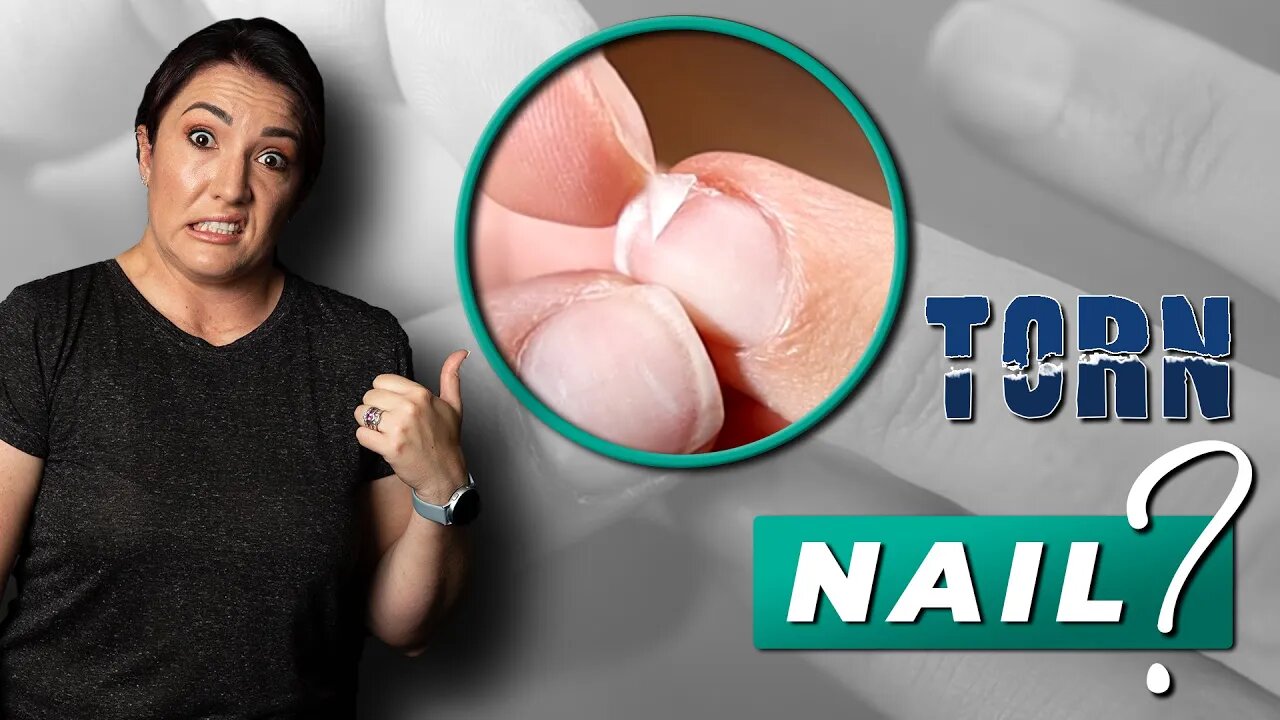 How to FIX a TORN NAIL | Quick & Easy (+ BONUS TIP)