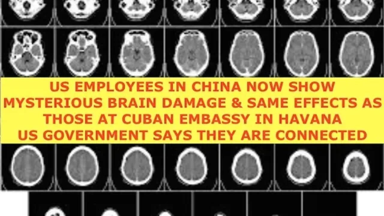Microwave Weapons in China and Cuba? US State Dept, Says Mysterious Illnesses Linked
