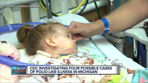 4 possible cases of polio-like illness in Michigan, according to Michigan Department of Health