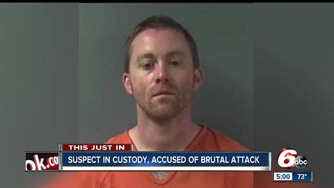 Man accused of brutally beating his girlfriend in custody