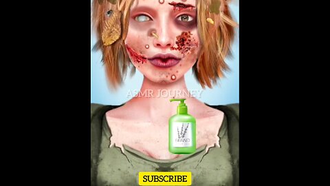 ASMR | Facial asmr scar treatment | Face Care Animation #asmr