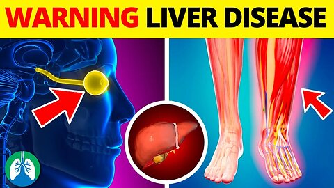 Top 10 Early Warning Signs of Liver Disease ⚠️