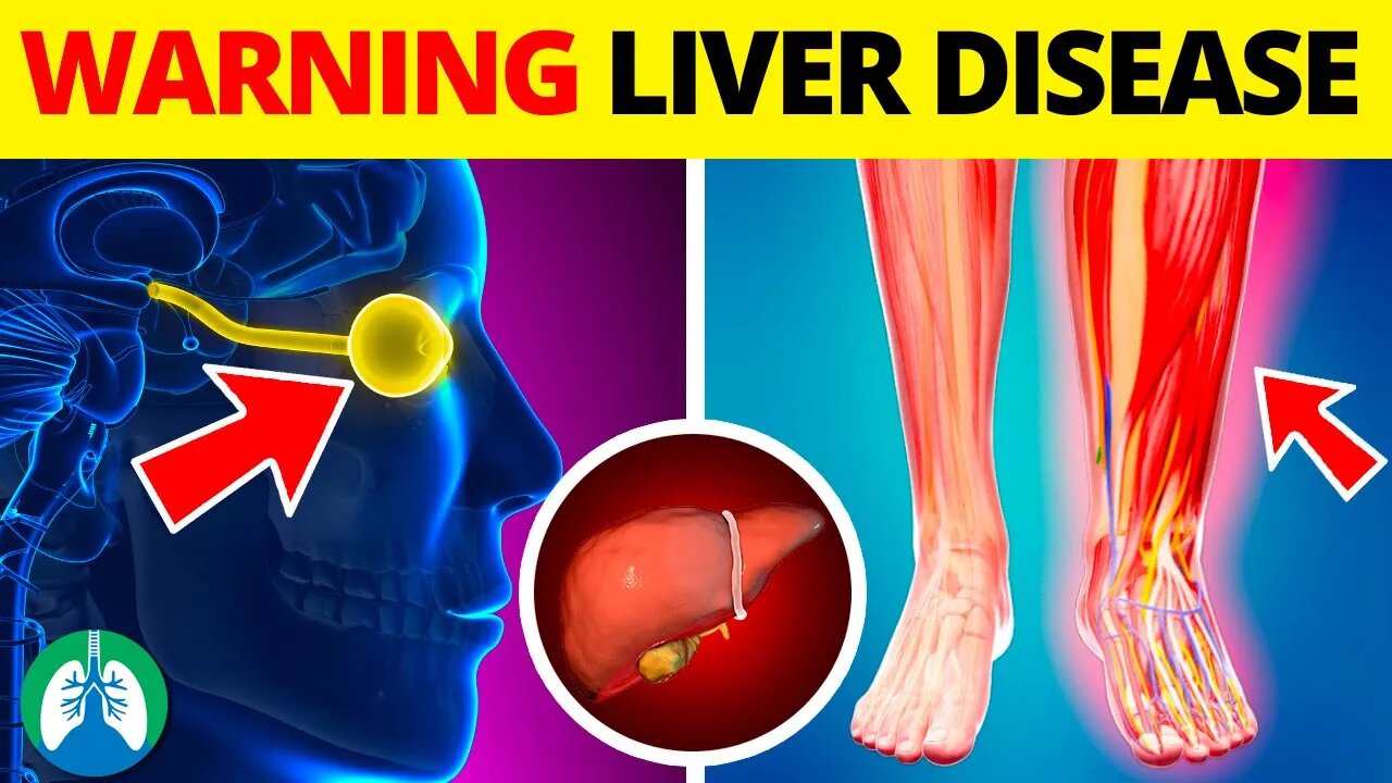 Top 10 Early Warning Signs of Liver Disease ⚠️