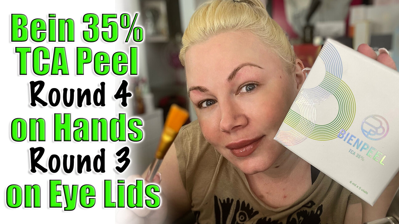 Bein 35% TCA Peel Round 4 on Hands and 3 on Eye Lids from Acecosm | Code Jessica10 saves you Money